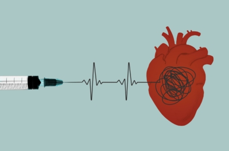 Họ bị viêm cơ tim sau khi chích vaccine COVID-19. Sau hàng năm, một số người vẫn chưa hồi phục