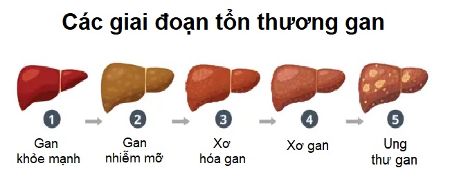 Cách giúp gan tự chữa lành tổn thương