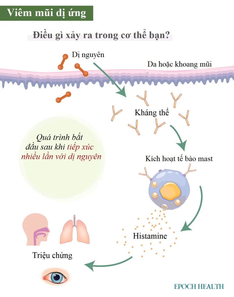 Hướng dẫn cơ bản về bệnh viêm mũi dị ứng: Triệu chứng, nguyên nhân, phương pháp điều trị và cách tiếp cận tự nhiên