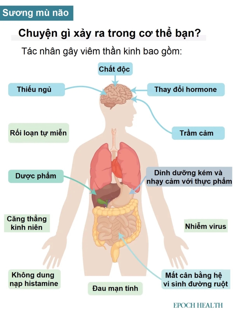 Hướng dẫn cơ bản về bệnh sương mù não: Triệu chứng, nguyên nhân, phương pháp điều trị và cách tiếp cận tự nhiên