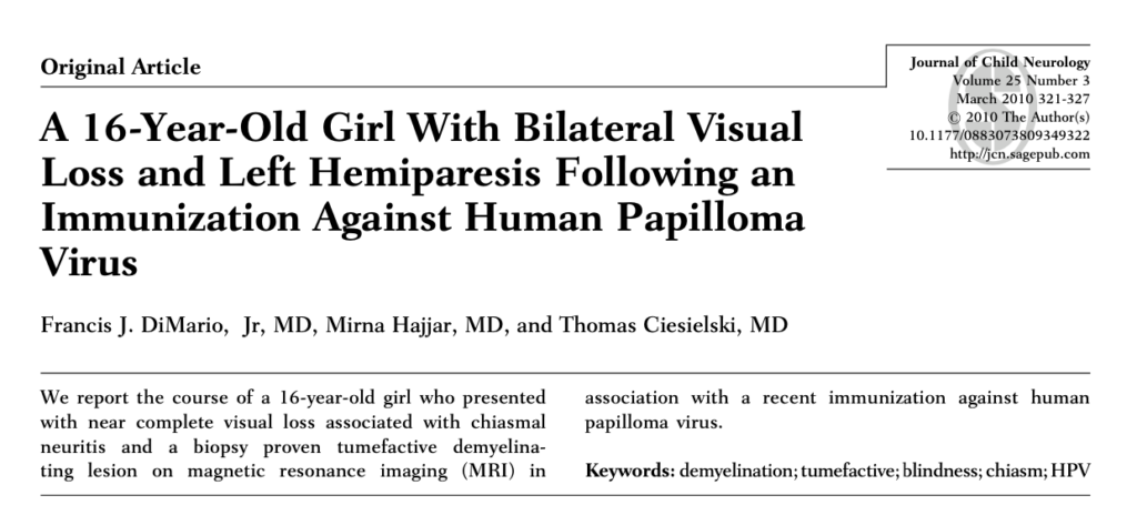 Một cô gái 16 tuổi bị mất thị lực hoàn toàn sau khi chích vaccine HPV, theo báo cáo của Tập san Thần kinh học Trẻ em ngày 25/02/2010. (Ảnh: Tập san Thần kinh học Trẻ em, Tập 25)