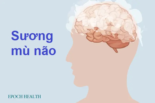 Hướng dẫn cơ bản về bệnh sương mù não: Triệu chứng, nguyên nhân, phương pháp điều trị và cách tiếp cận tự nhiên