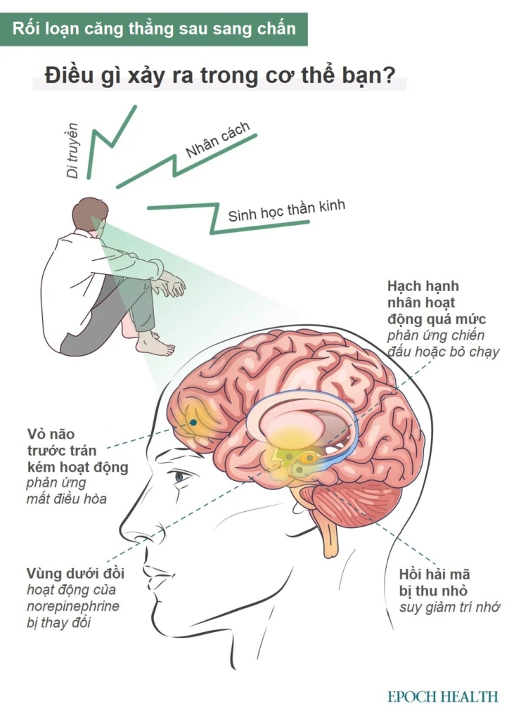 Hướng dẫn cơ bản về Rối loạn căng thẳng sau sang chấn (PTSD): Triệu chứng, nguyên nhân, điều trị và cách tiếp cận tự nhiên