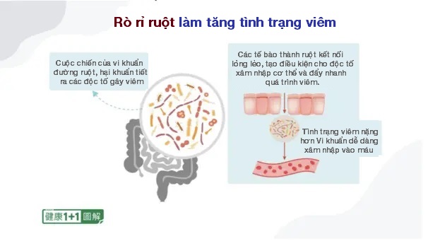 Chuyên gia probiotics: Lão hóa khỏe mạnh bắt nguồn từ hệ vi sinh vật đường ruột khỏe mạnh