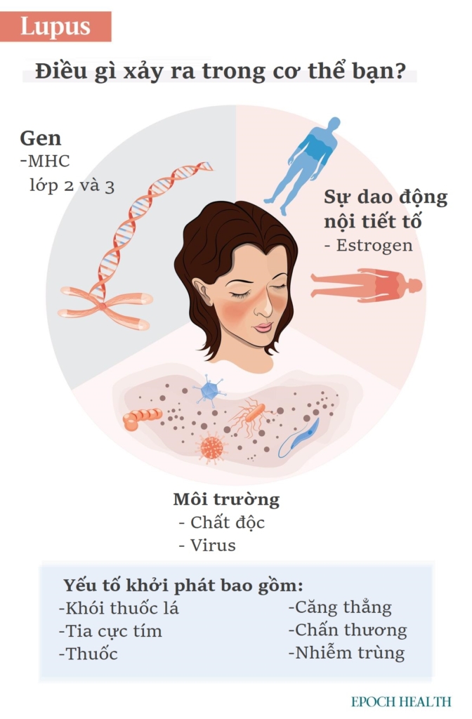 Hướng dẫn cơ bản về bệnh Lupus: Triệu chứng, nguyên nhân, điều trị và cách tiếp cận tự nhiên