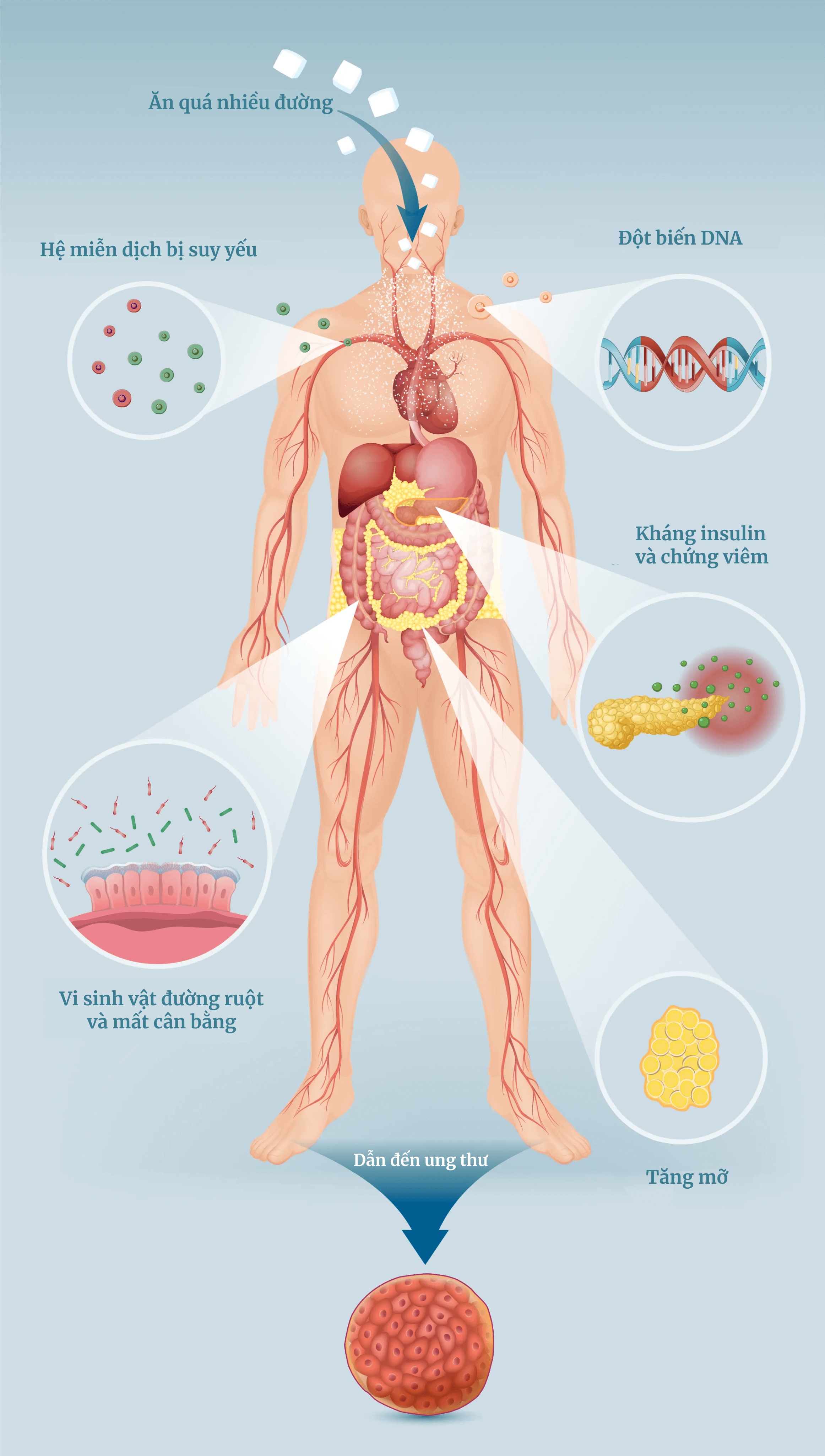 Đường gây ra nhiều thay đổi trong cơ thể mà cuối cùng dẫn đến tăng nguy cơ ung thư. (Ảnh minh họa của The Epoch Times, Shutterstock)