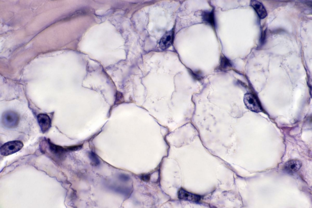 Tế bào mỡ trong mô mỡ (độ phóng đại 250x). (Ảnh: Ed Reschke/Getty Images)