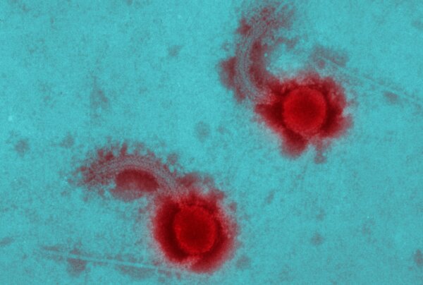 Hình ảnh hiển vi điện từ của một vi khuẩn. Hoa Kỳ sử dụng thể thực khuẩn, virus diệt vi khuẩn, trong chế biến thịt. (Hình ảnh Source Trading Ltd/Shutterstock)