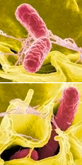 Vi khuẩn Salmonella xâm nhập vào tế bào người. (Ảnh: NIAID)