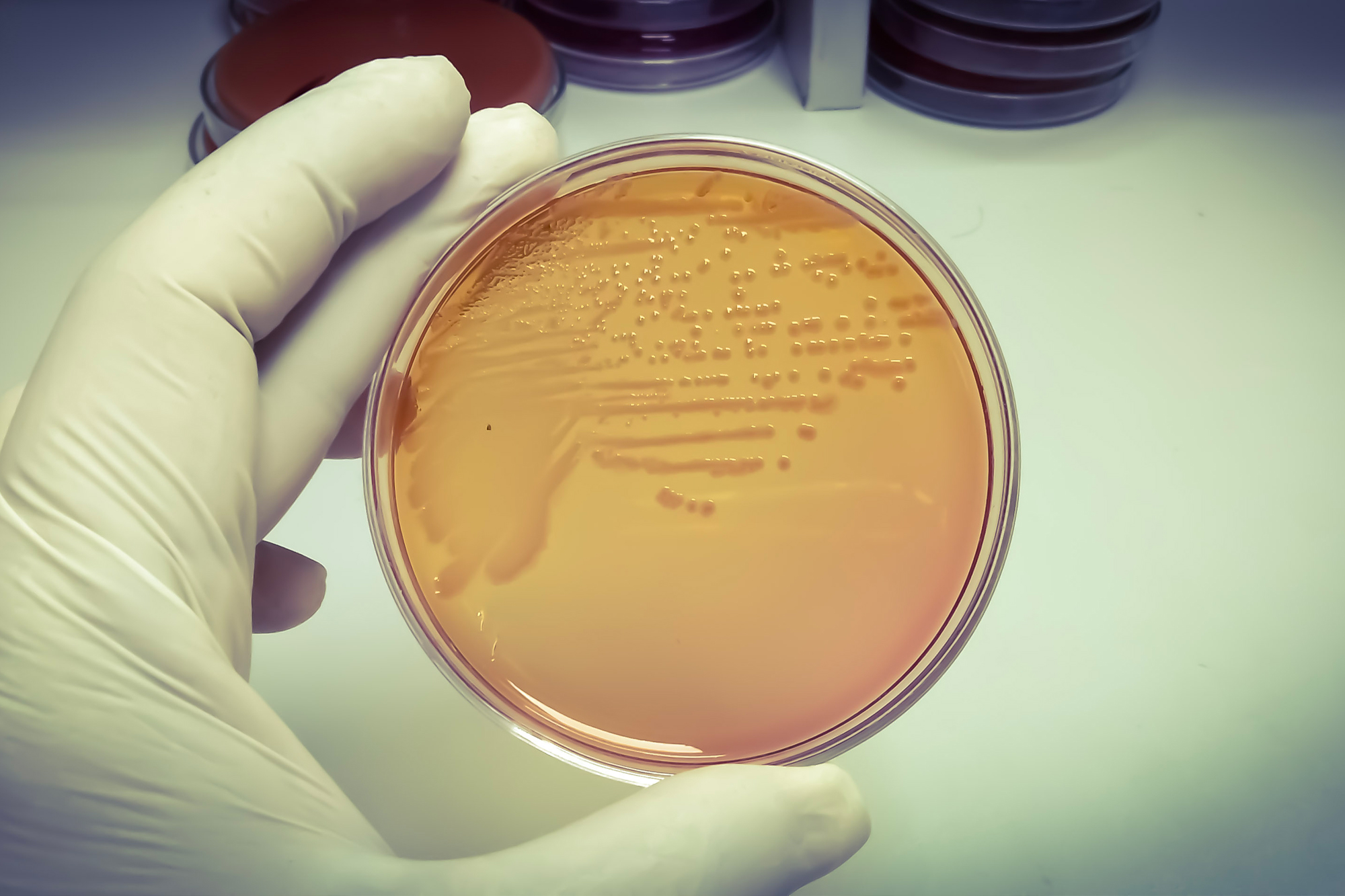 Nuôi cấy vi khuẩn là cách đáng tin cậy nhất để chẩn đoán nhiễm khuẩn salmonella. (Ảnh: Arif Biswas/Shutterstock)