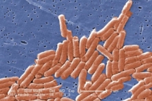 Hình ảnh kính hiển vi điện tử được tô màu bằng kỹ thuật số của một nhóm trực khuẩn gram âm, hoặc hình que, vi khuẩn Salmonella sp. (Ảnh: Janice Haney Carr/CDC)