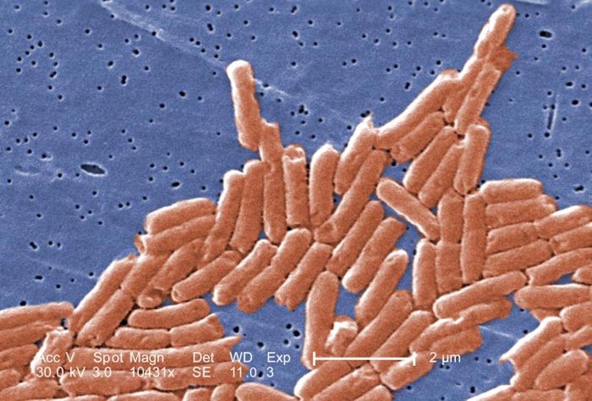 Hình ảnh kính hiển vi điện tử được tô màu bằng kỹ thuật số của một nhóm trực khuẩn gram âm, hoặc hình que, vi khuẩn Salmonella sp. (Ảnh: Janice Haney Carr/CDC)