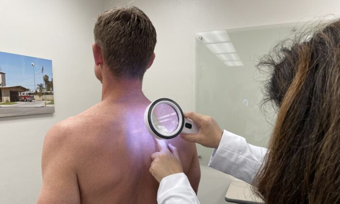 Tiến sĩ Tanya Evans từ CalDerm được nhìn thấy đang thực hiện sàng lọc điểm ung thư da trên một lính cứu hỏa ở Huntington Beach, California, vào ngày 30/4/2023. (Ảnh: Sophie Li/The Epoch Times)