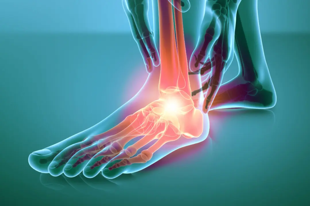 Năm bài tập giảm đau do bệnh Gout