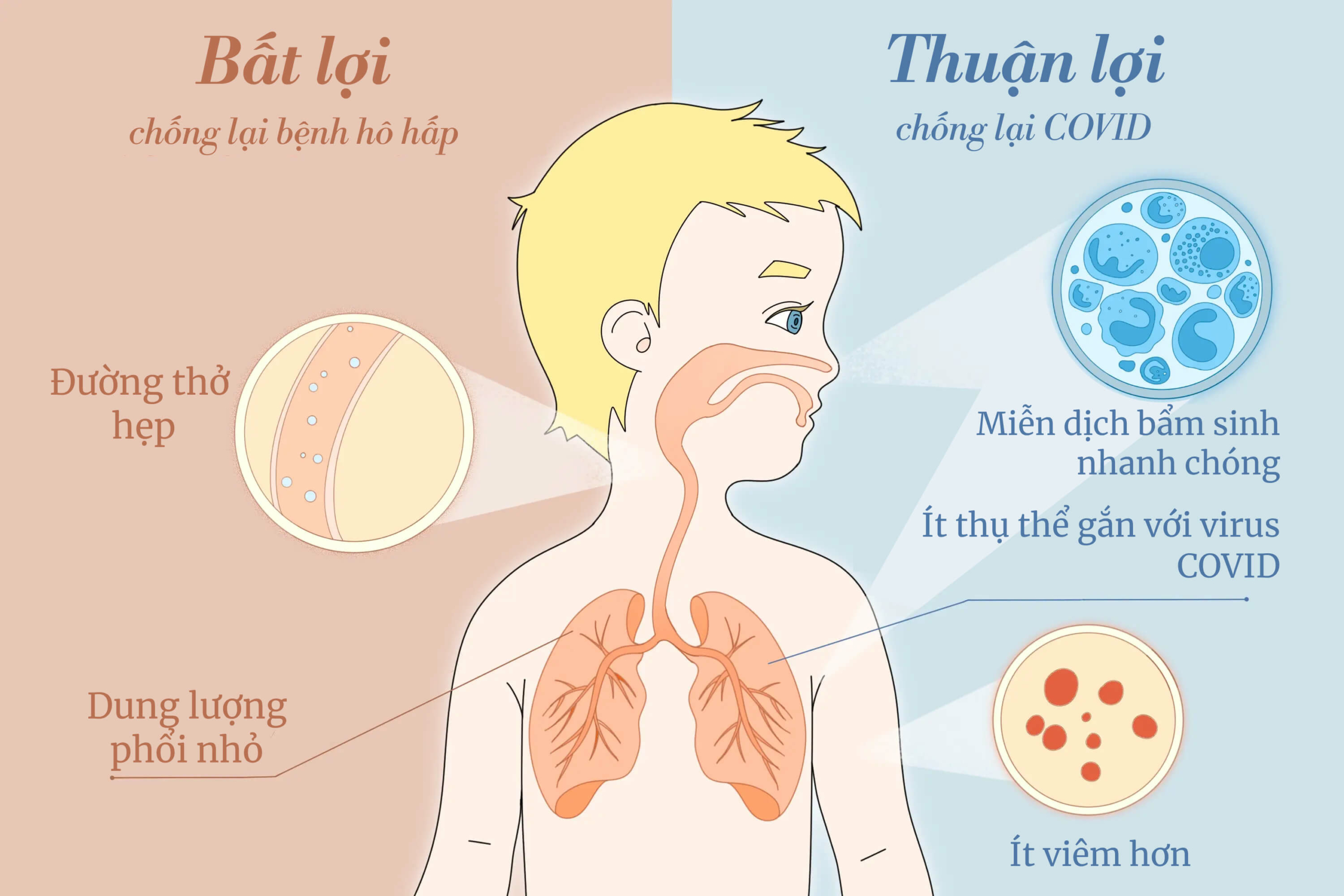 Những thuận lợi và bất lợi của trẻ em khi chiến đấu với các bệnh lý đường hô hấp. (Ảnh: Minh họa của The Epoch Times, Shutterstock)