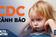 CDC và WHO đưa ra cảnh báo về một căn bệnh cũ đã quay trở lại