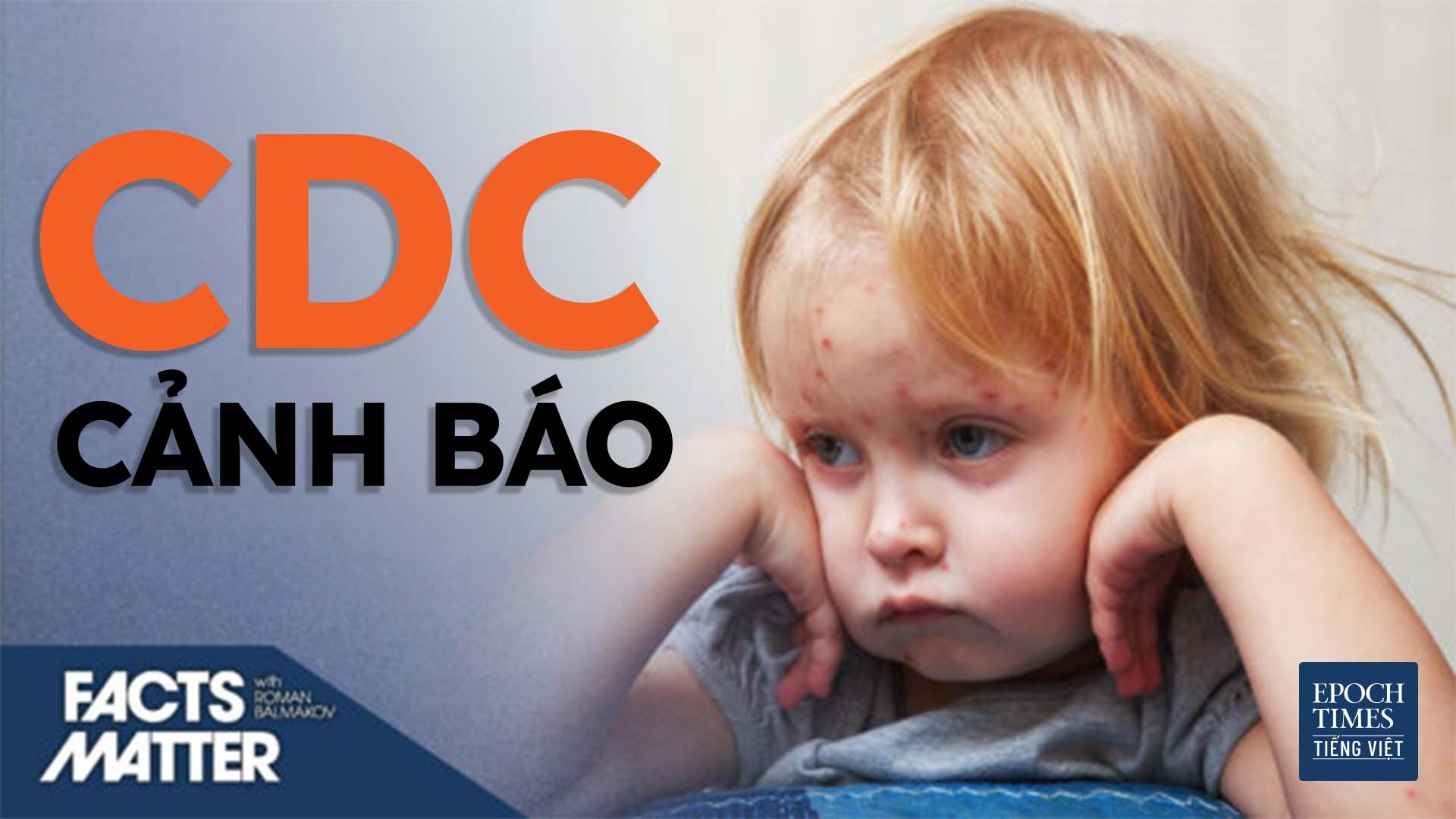 CDC và WHO đưa ra cảnh báo về một căn bệnh cũ đã quay trở lại