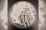 Bức ảnh không ghi ngày tháng do Trung tâm Kiểm soát và Phòng ngừa Dịch bệnh cung cấp cho thấy một chủng Candida auris được nuôi cấy trong đĩa petri tại phòng thí nghiệm CDC. (Ảnh: The Canadian Press/Shawn Lockhart-CDC via AP)