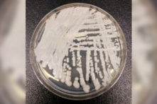 Bức ảnh không ghi ngày tháng do Trung tâm Kiểm soát và Phòng ngừa Dịch bệnh cung cấp cho thấy một chủng Candida auris được nuôi cấy trong đĩa petri tại phòng thí nghiệm CDC. (Ảnh: The Canadian Press/Shawn Lockhart-CDC via AP)