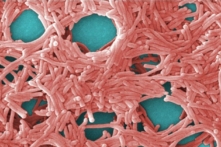 Ảnh hiển vi điện tử quét màu (SEM) của vi khuẩn Legionella pneumophila. (Ảnh: Janice Haney Carr/CDC/Public Domain)