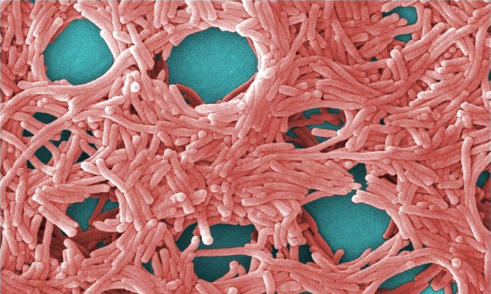 Ảnh hiển vi điện tử quét màu (SEM) của vi khuẩn Legionella pneumophila. (Ảnh: Janice Haney Carr/CDC/Public Domain)