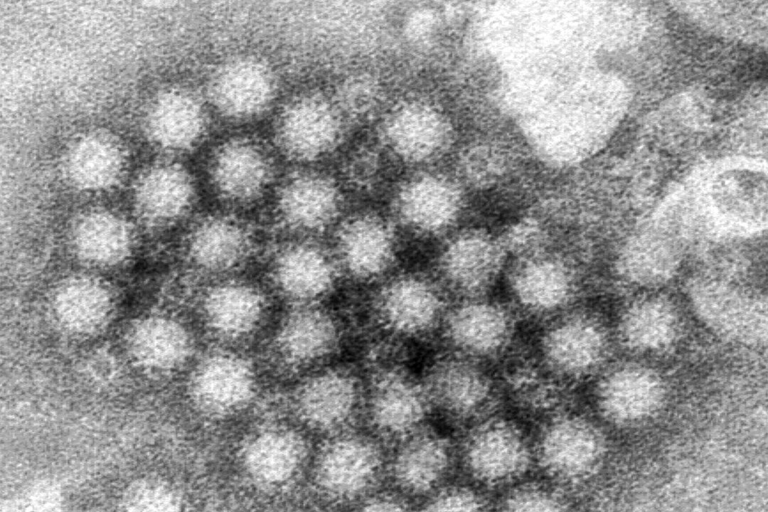Bệnh Norovirus xuất hiện ở một số địa phương —Những điều mà bạn cần biết