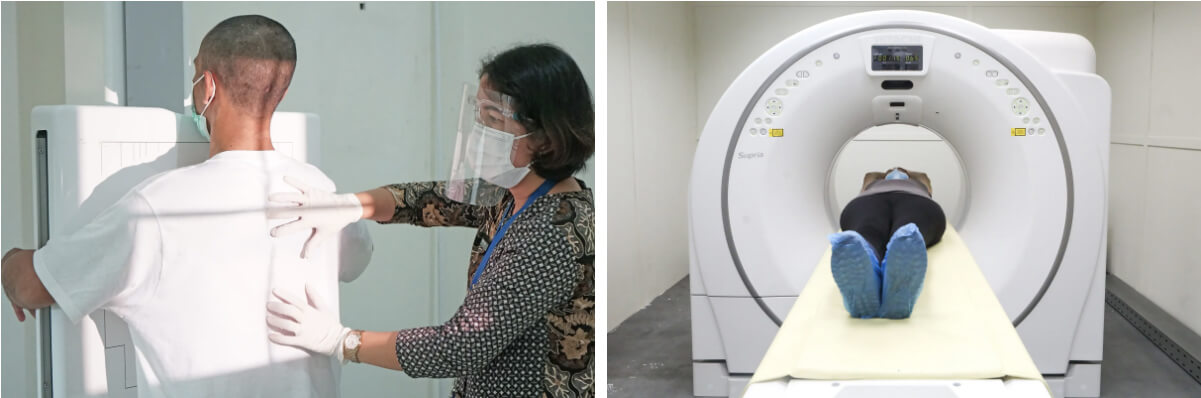 Chụp X-quang ngực hoặc chụp CT có thể giúp tìm ra nguyên nhân cơ bản gây ho mạn tính, bao gồm cả ung thư phổi. (Ảnh: pardi hutabarat/Shutterstock, Pimen/Shutterstock)