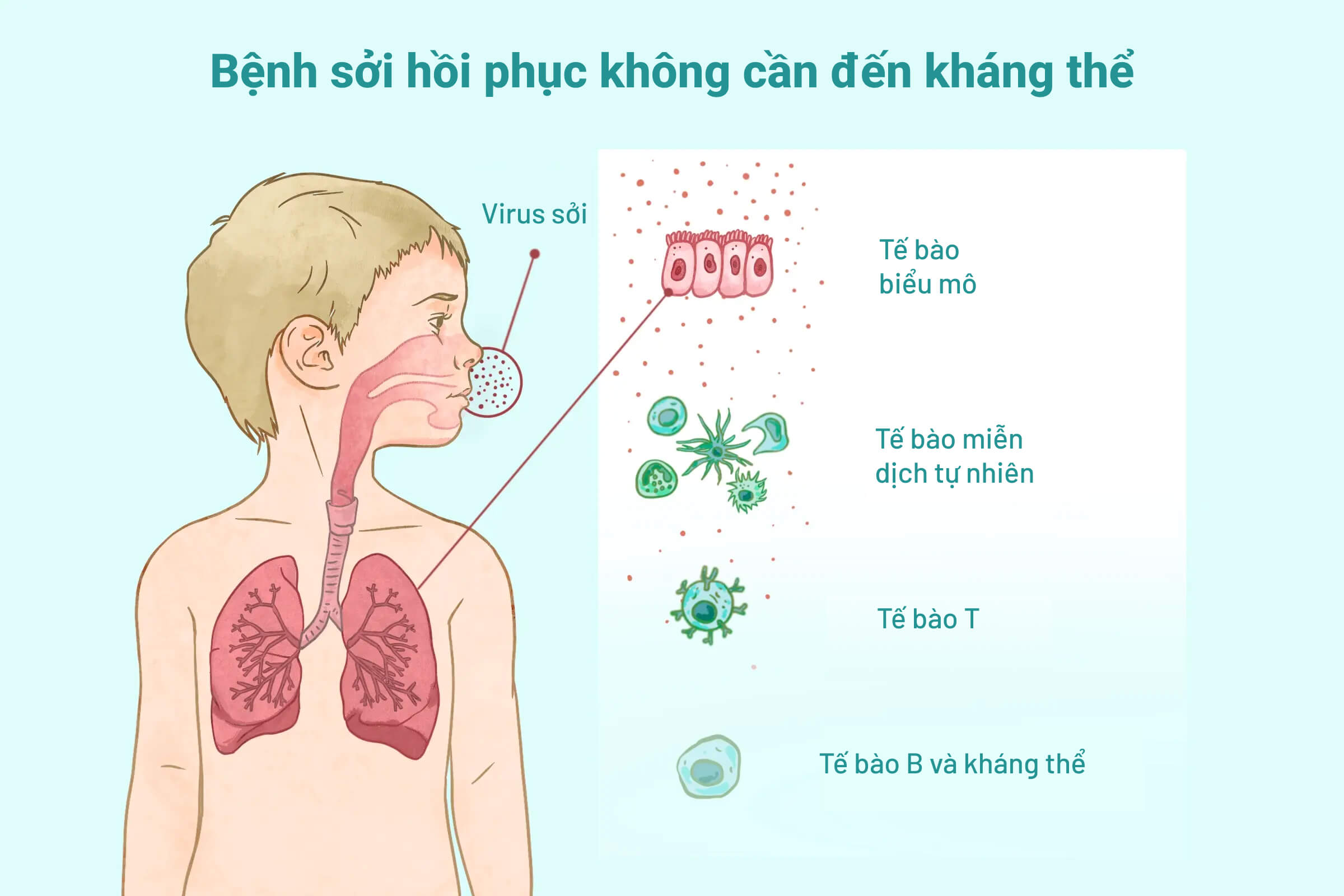 Trẻ không có khả năng sản xuất kháng thể vẫn có thể khỏi bệnh sởi tốt. (Minh họa của The Epoch Times)