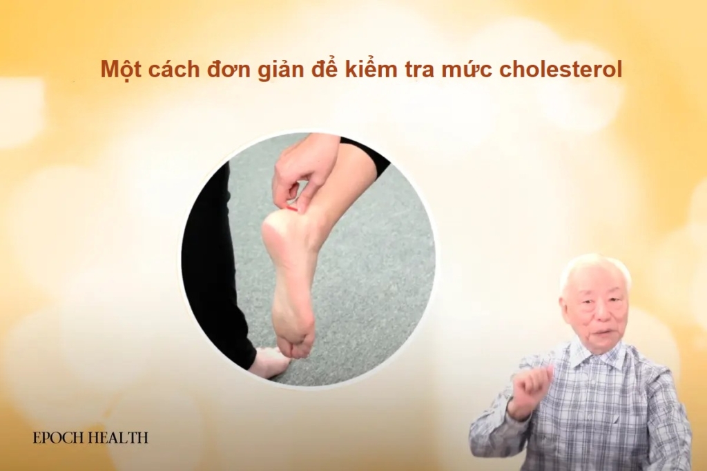 5 loại thực phẩm giúp hạ cholesterol và cách đơn giản để kiểm tra mức cholesterol