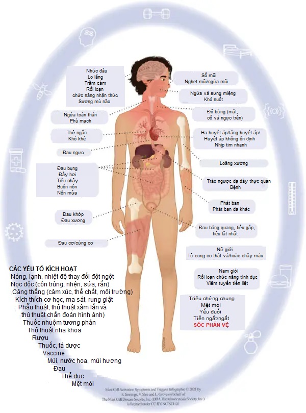 Làm thế nào để chẩn đoán Hội chứng kích hoạt tế bào mast