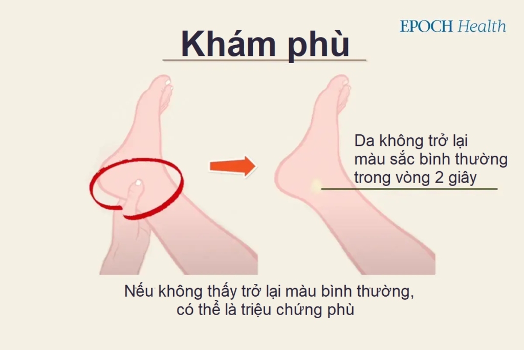 2 loại béo phì theo Trung y và phương pháp giảm cân cổ xưa