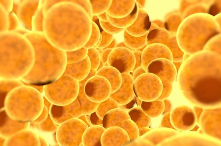 Mỡ nội tạng: Kẻ giết người vô hình có thể gây ung thư