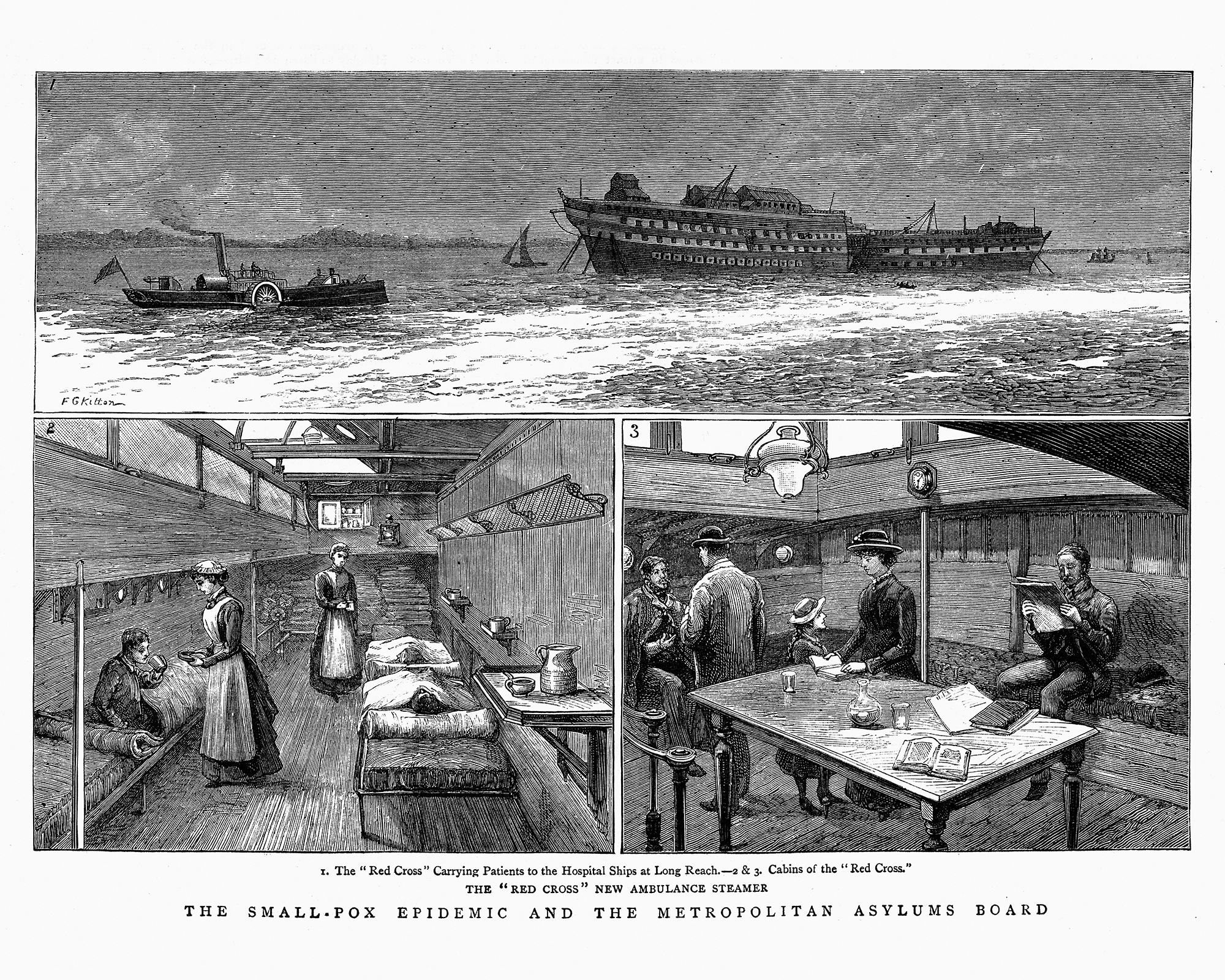 Dịch bệnh đậu mùa với các tàu bệnh viện chở bệnh nhân đến Long Reach, 1884. (Ảnh: Stock-Grafiken/GettyImage)