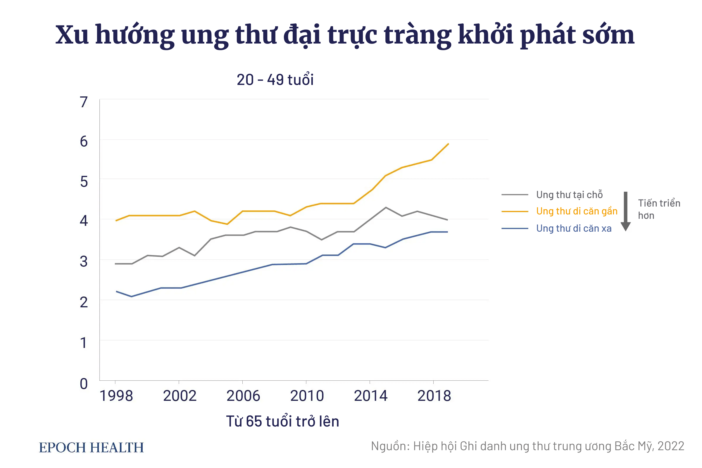 Tỷ lệ ung thư đại trực tràng tiến triển đã tăng ở những người từ 20 đến 49 tuổi. (Ảnh: The Epoch Times)