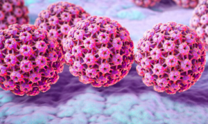 Phương pháp tự lấy mẫu xét nghiệm HPV đã được phê chuẩn, có thể làm tăng tỷ lệ xét nghiệm đang bị tụt hậu của Hoa Kỳ