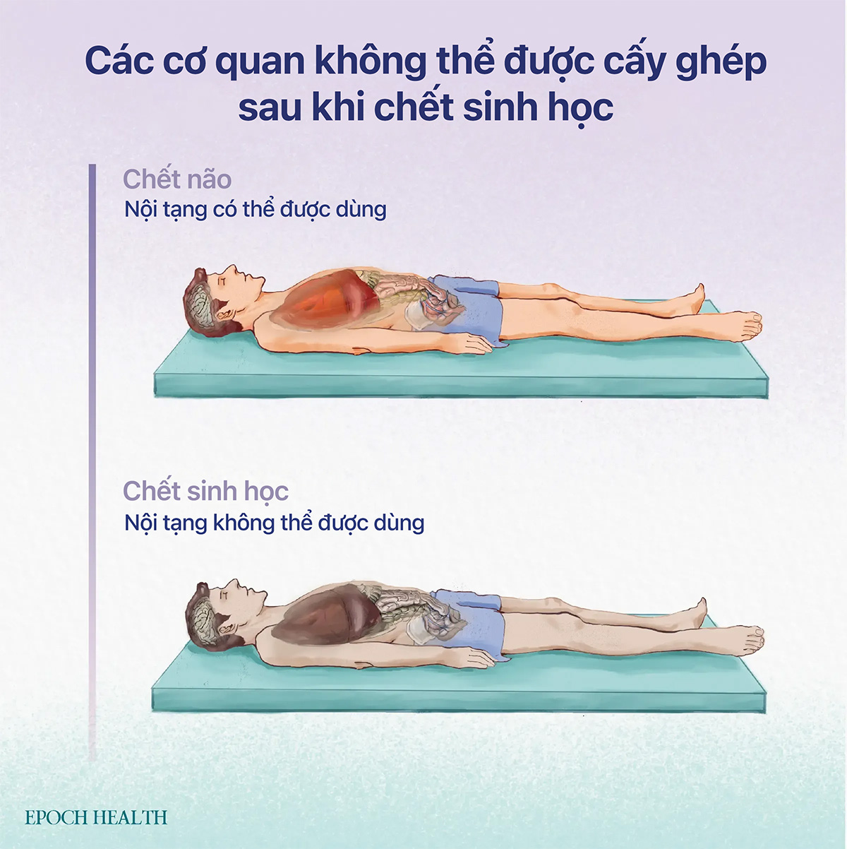 Một khi người đã chết về mặt sinh học, nội tạng của họ không thể được thu hoạch để hiến tặng. (Ảnh minh họa bởi The Epoch Times)