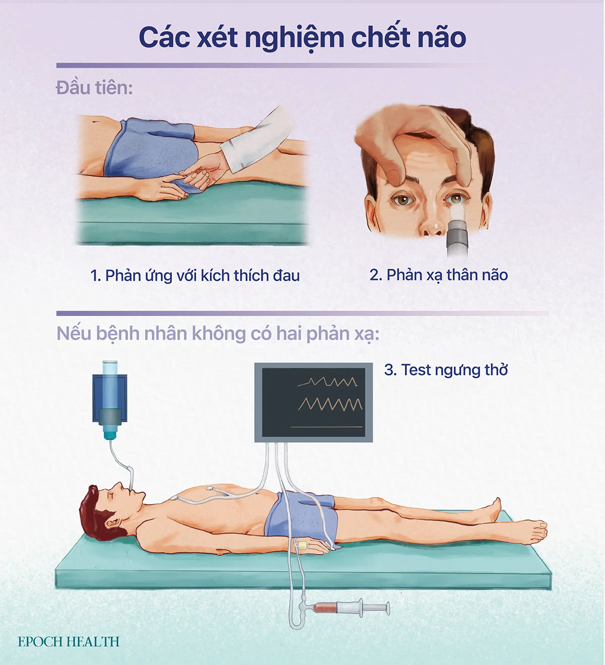 Để đánh giá tình trạng chết não, các bác sĩ dùng kích thích đau, kiểm tra phản xạ thân não, sau đó tiến hành test ngưng thở nếu bệnh nhân không đáp ứng với cả hai phản xạ đau và phản xạ thân não. (Ảnh minh hoạ bởi The Epoch Times)